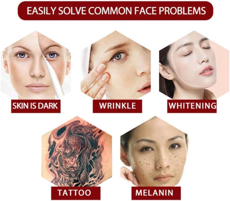 Máquina láser GURSAC Picosegundos: la solución definitiva para eliminar tatuajes y pigmentos